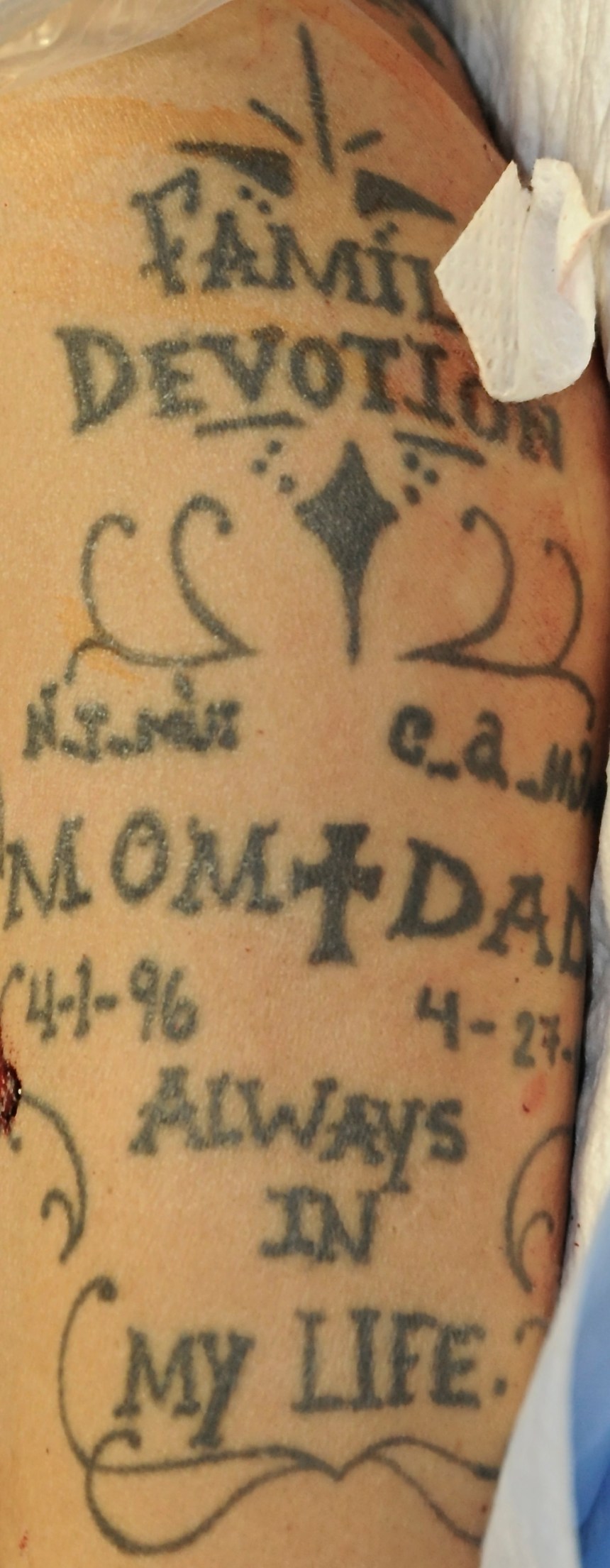 Arm%20Upper%20Left%201