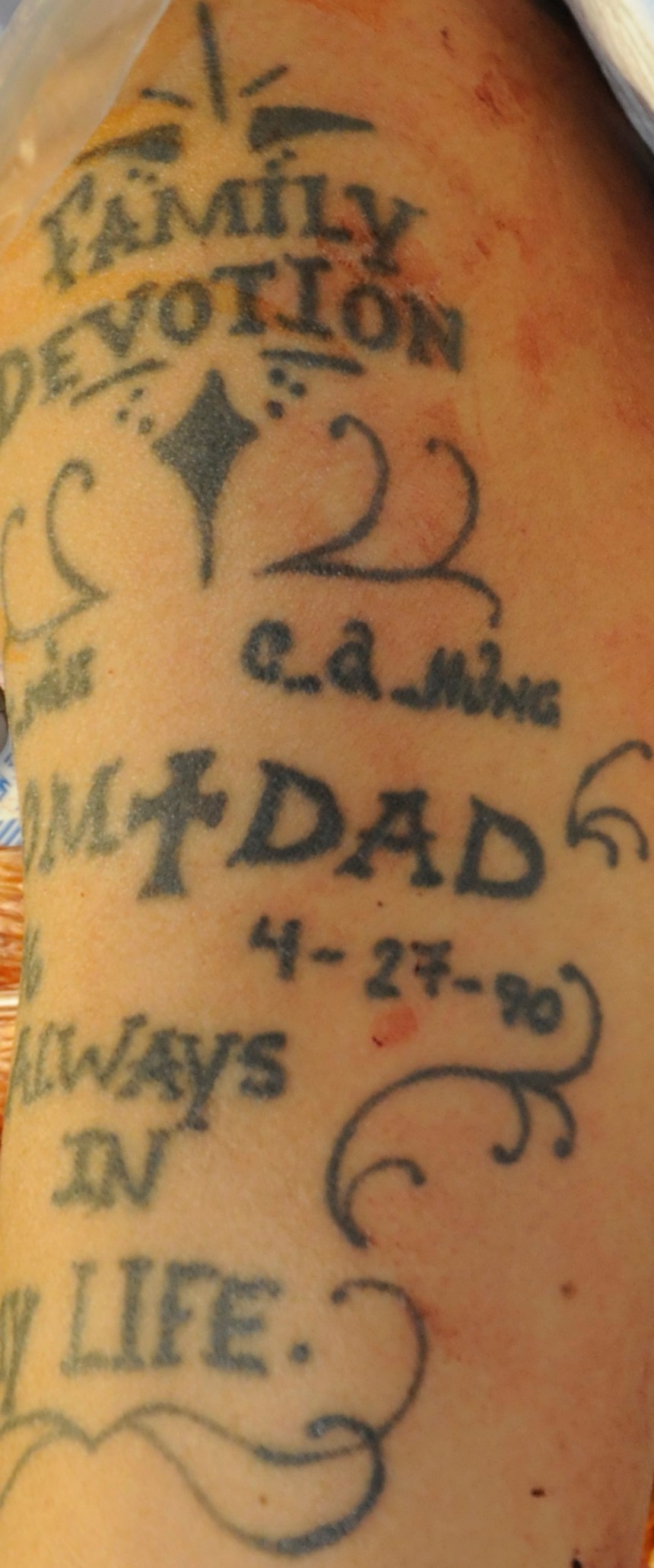 Arm%20Upper%20Left%202